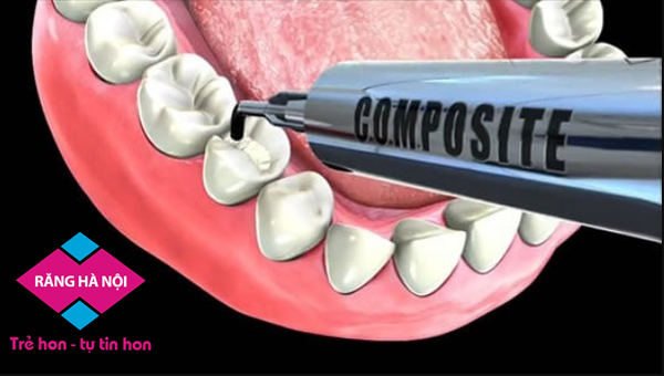 composite