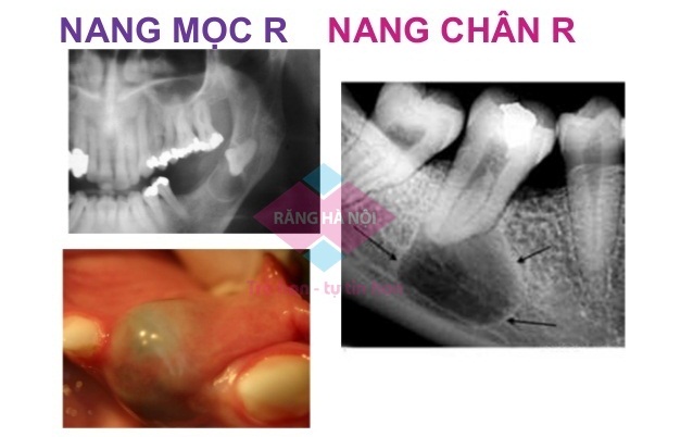 nang-chan-rang1