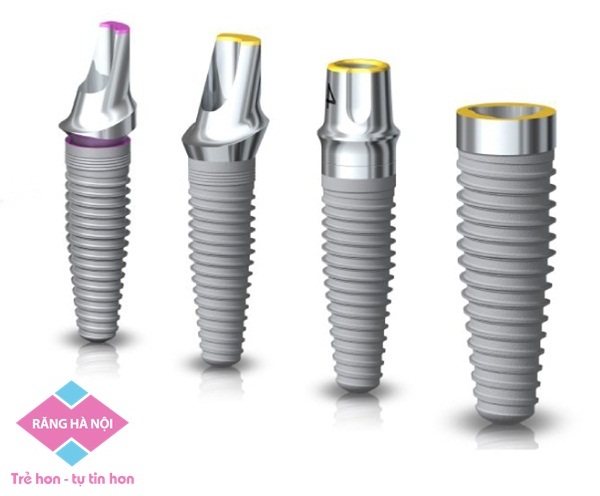 implant-thuy-dien