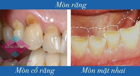 Mon rang