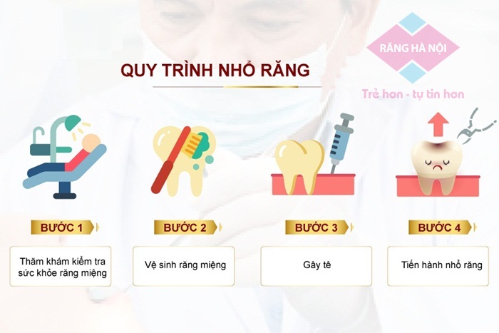 quy-trinh-nho-rang