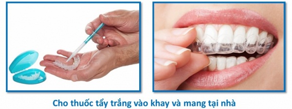 tay trang rang deo mang