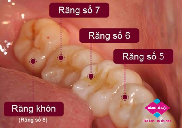nho rang