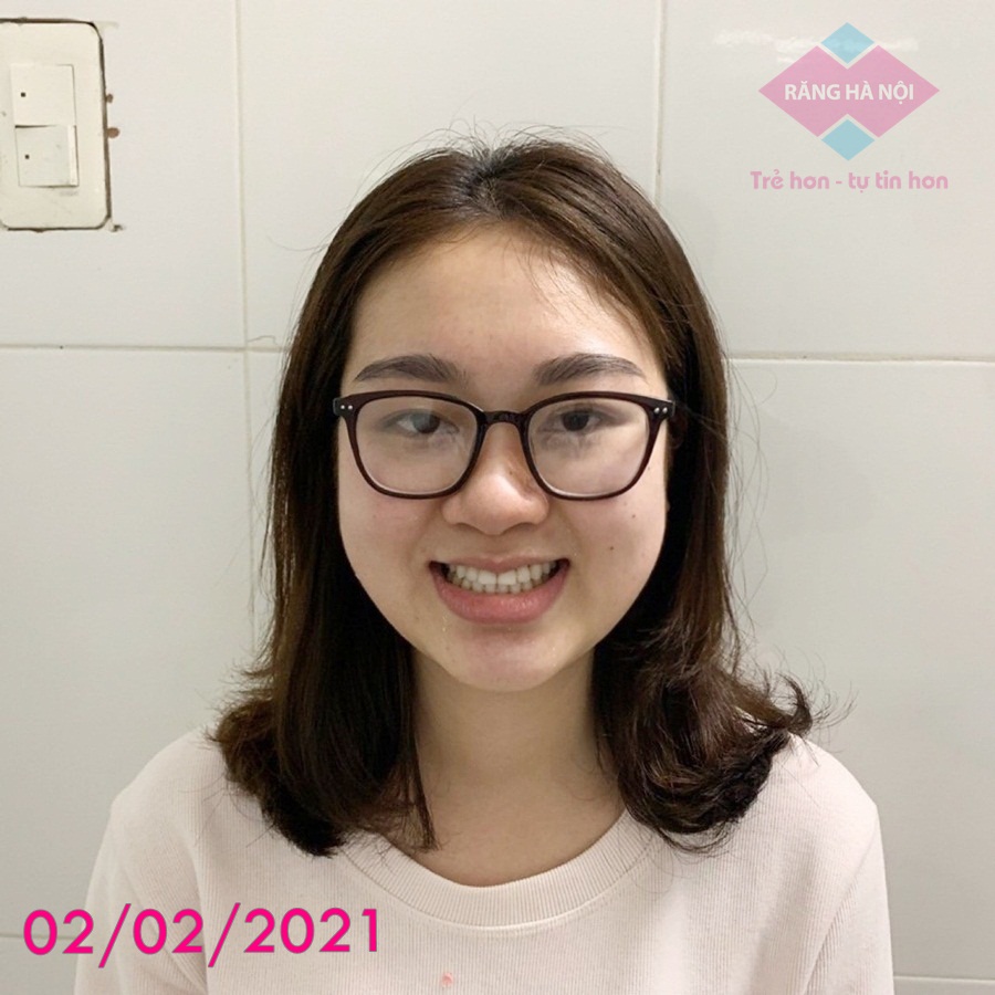 Hà Thị Chi - Hàng Cót