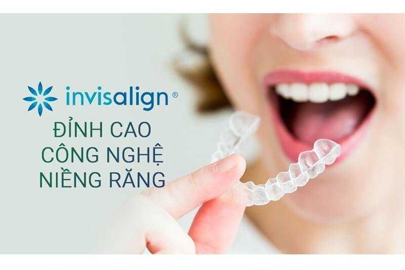Chỉnh Nha INVISALIGN