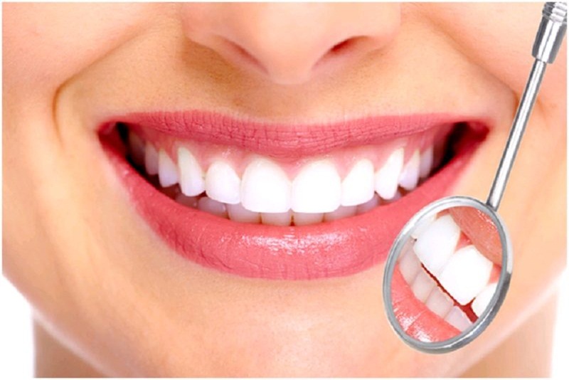 RĂNG SỨ THẨM MỸ