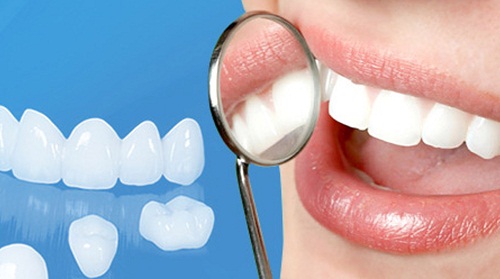 Răng sứ không kim loại Cercon HT