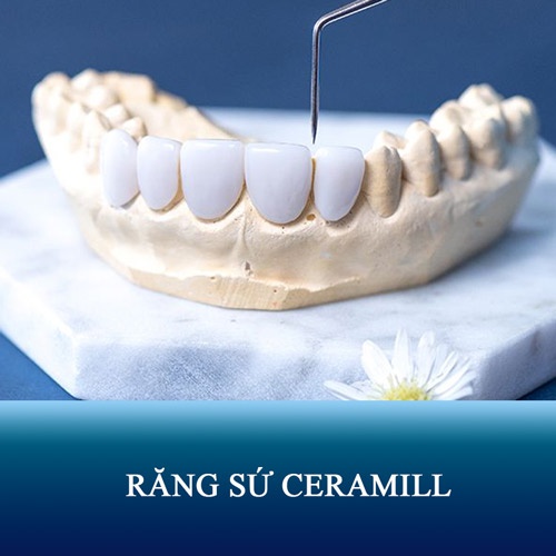 Răng sứ không kim loại Ceramill