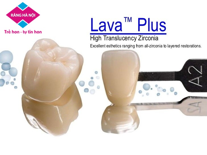 Răng sứ không kim loại Lava Plus