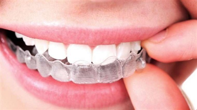 Làm Trắng Răng Tại Nhà Để Duy Trì Răng Tẩy Trắng