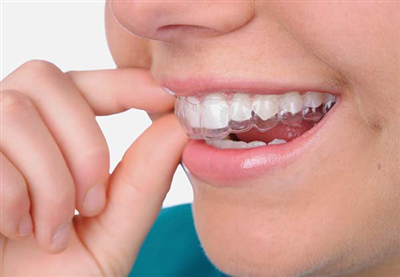 Vai Trò Của Máng Chống Nghiến