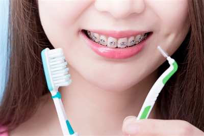 Tại Sao Nên Dùng Bàn Chải Kẽ Răng Cho Răng Niềng?