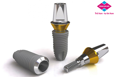 Ưu Điểm Vượt Trội Của Dòng Trụ Implant Straumann Thụy Sĩ