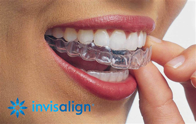 VÌ SAO PHẢI ĐEO KHAY NIỀNG INVISALIGN ÍT NHẤT 22H/ NGÀY?