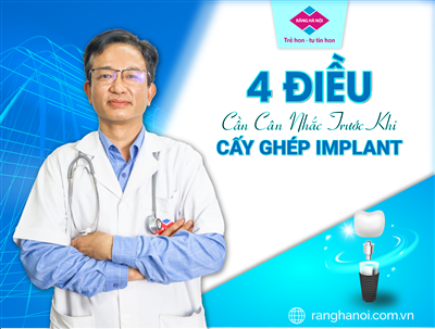 NHỮNG ĐIỀU NÊN CÂN NHẮC KĨ TRƯỚC KHI CẤY GHÉP IMPLANT?