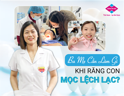 BA MẸ CẦN LÀM GÌ KHI RĂNG CON MỌC LỆCH LẠC?
