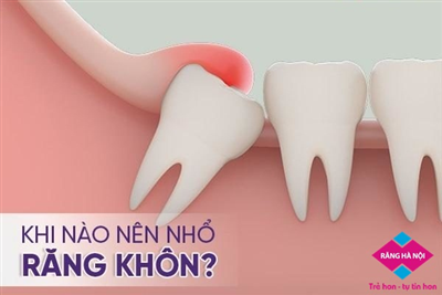 HỒNG AN - HÀ NỘI: 