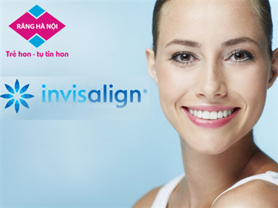 Niềng răng trong suốt Invisalign và những điều cần biết?