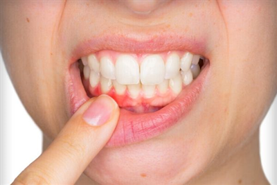 Báo động đỏ về tình trạng răng miệng ở Việt Nam
