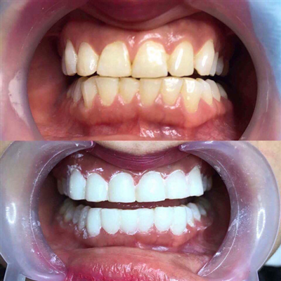 SỰ THẬT VỀ 