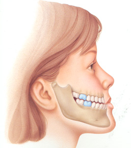 Dấu hiệu nên đưa trẻ đi khám răng hàm mặt