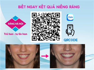 CHECK QR CODE - BIẾT NGAY KẾT QUẢ NIỀNG RĂNG
