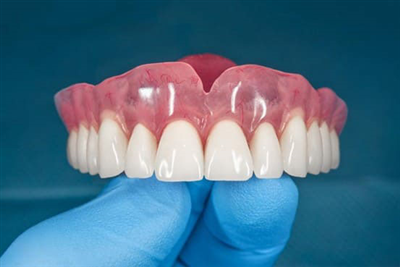Hướng dẫn cách lắp răng giả